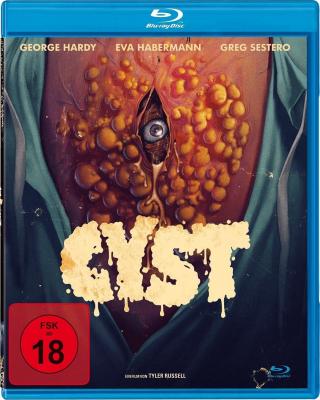 囊肿 CYST (2020) 